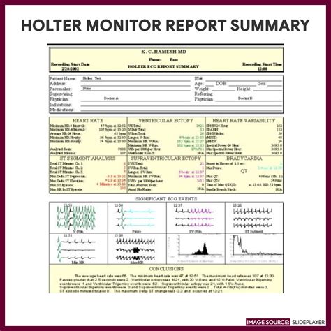 holter monitor results example